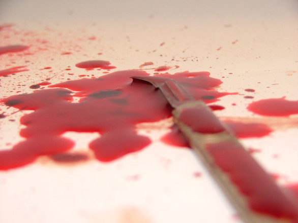 Трагедия в Харькове: пенсионерка истекла кровью в собственном доме (фото)