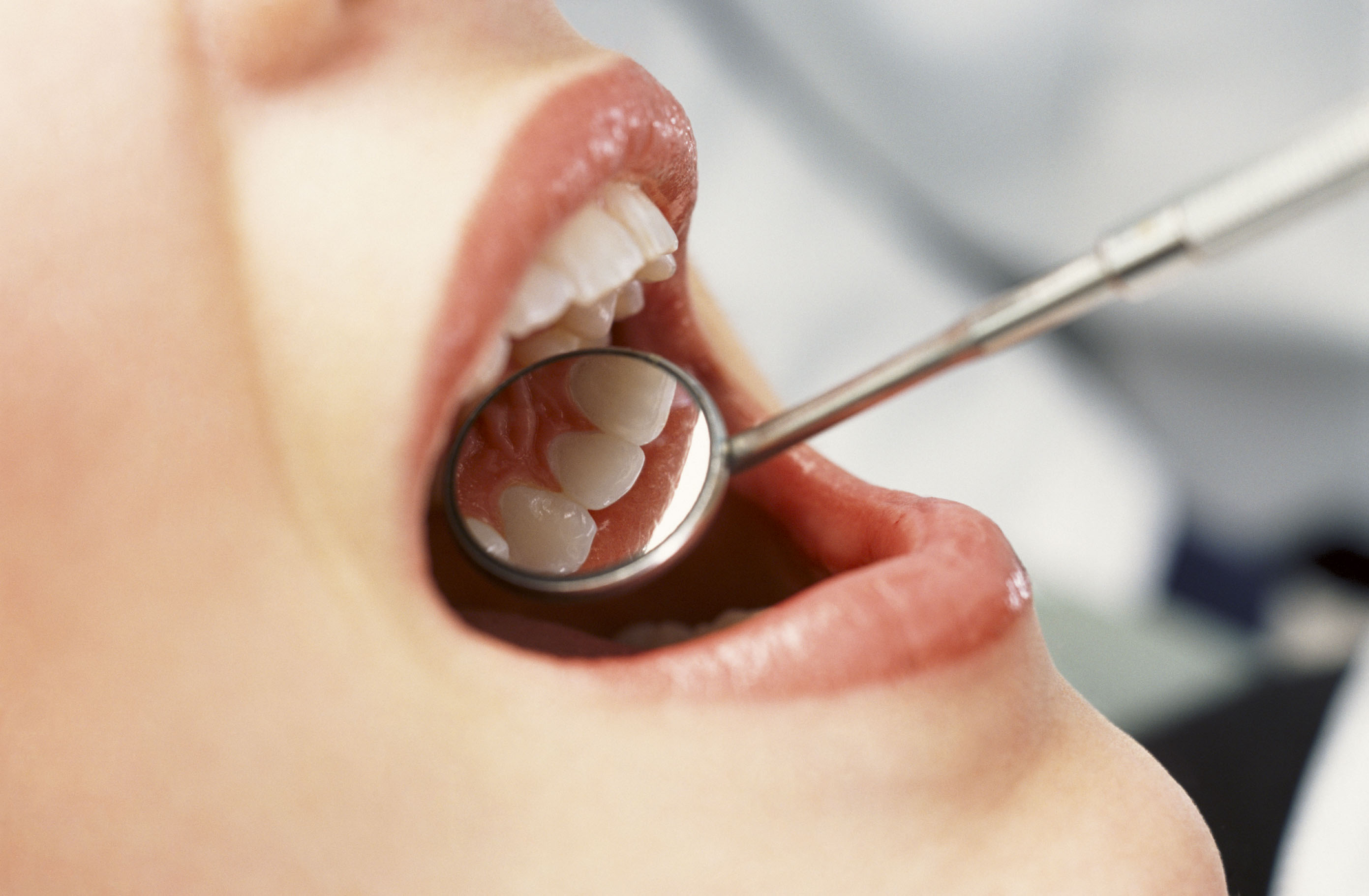 Как спасти зубы в безнадежной ситуации. Советы стоматолога